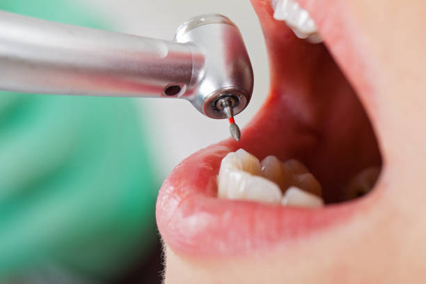 Best Emergency Dental Care for Sports Injuries in Buffalo, OK